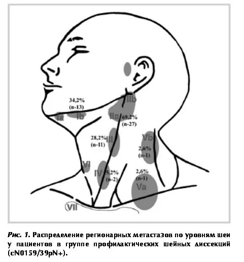 Расположение лимфоузлов на шее спереди схема лимфоузлы расположение схем � - vrogue.co