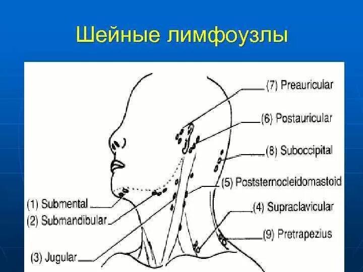 Расположение лимфоузлов на шее спереди схема Лимфоузлы на шее расположение схема