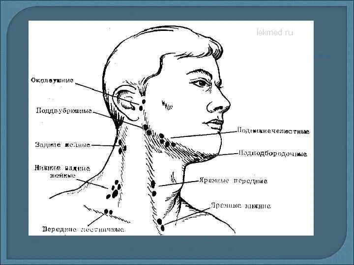 Расположение лимфоузлов на шее спереди схема Твердые лимфатические узлы