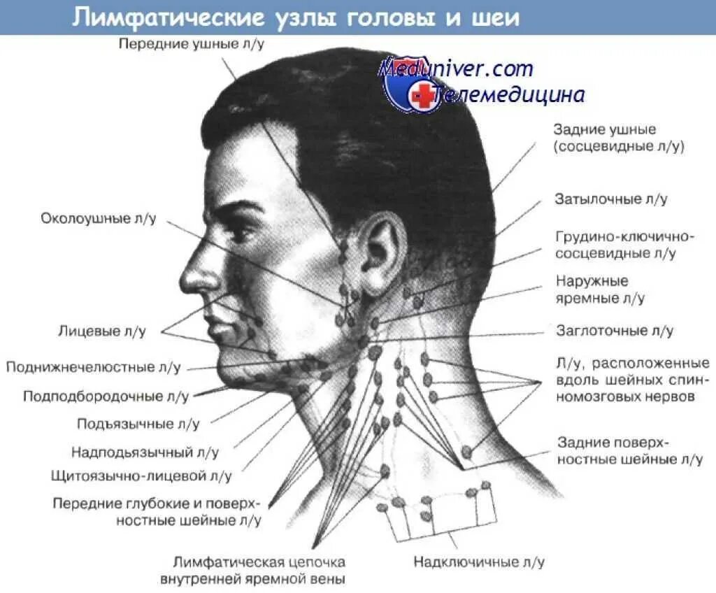 Расположение лимфоузлов на шее спереди схема Картинки УВЕЛИЧЕНИЕ ЗАДНЕШЕЙНЫХ ЛИМФАТИЧЕСКИХ УЗЛОВ