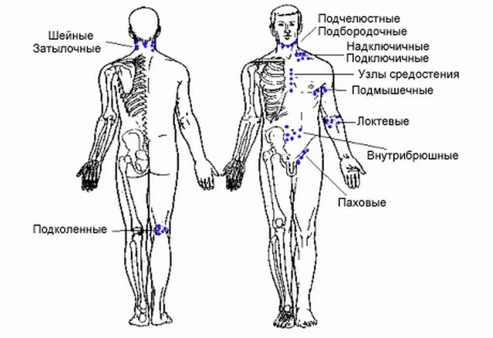 Расположение лимфоузлов в паху у мужчин схема Картинки ПРОХОДЯ ЧЕРЕЗ ЛИМФАТИЧЕСКИЕ УЗЛЫ