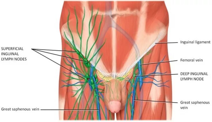 Расположение лимфоузлов в паху у мужчин схема Причины и клиническая картина при паховом лимфогранулематозе - Estet-Portal