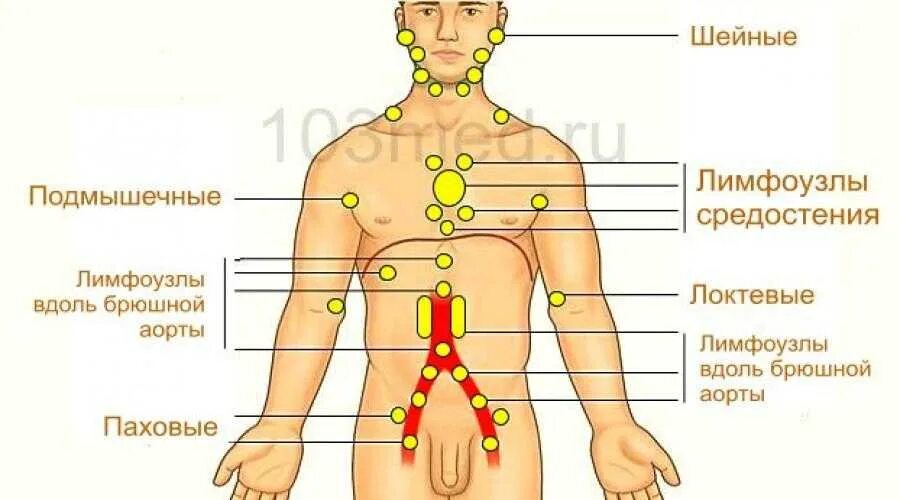 Расположение лимфоузлов в паху у мужчин схема Картинки ПАХОВЫЕ ЛИМФАТИЧЕСКИЕ УЗЛЫ РАЗМЕРЫ