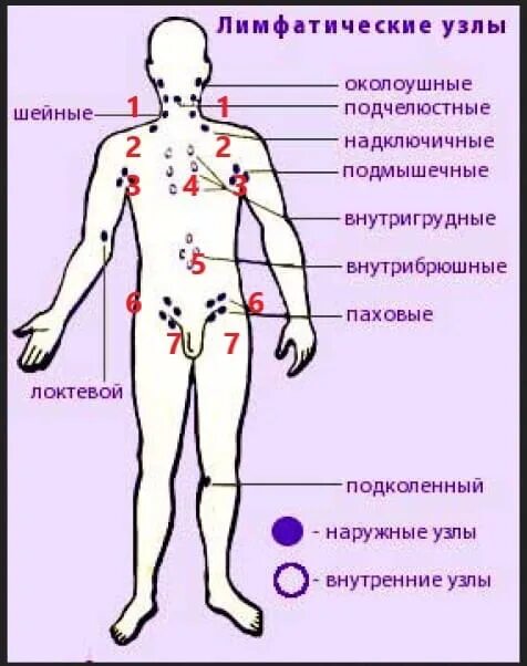 Расположение лимфоузлов в паху у мужчин схема Картинки ЛИМФАТИЧЕСКИЕ УЗЛЫ У ЖЕНЩИН