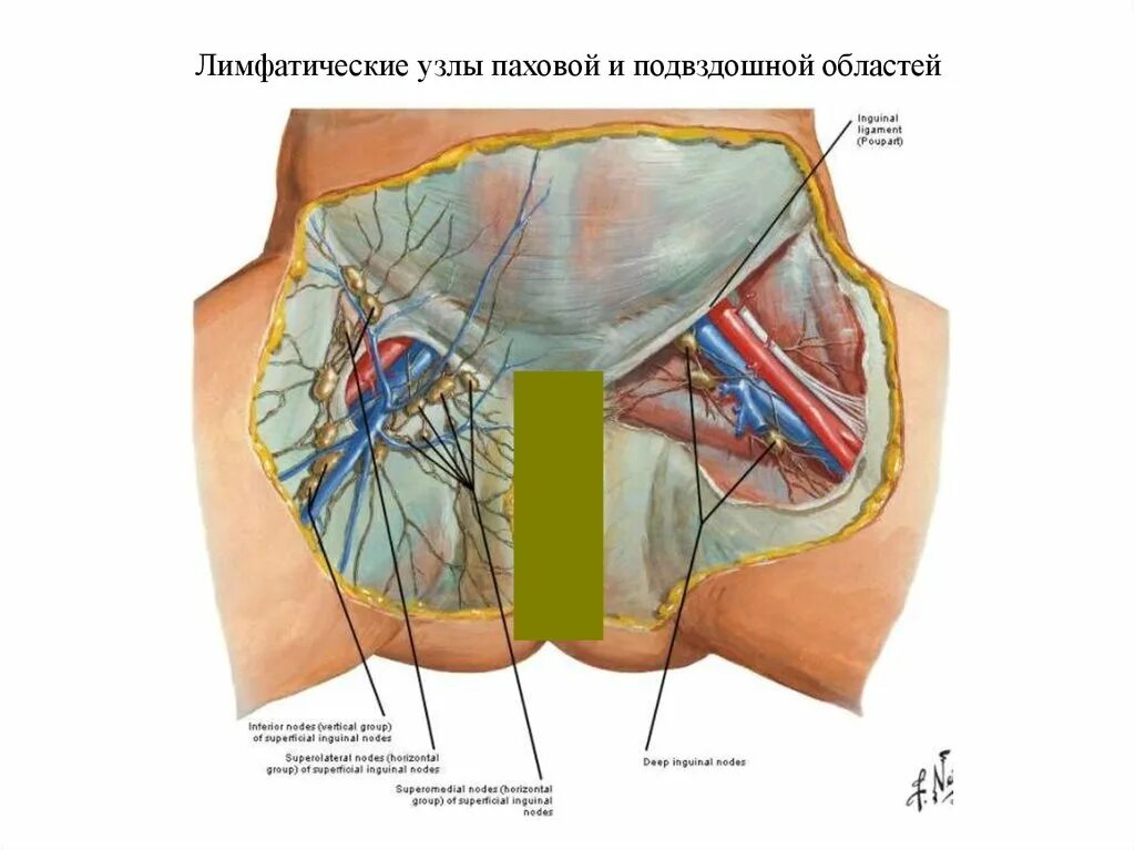 Расположение лимфоузлов в паху у женщин схема Картинки ПАХОВЫЕ ЛИМФАТИЧЕСКИЕ УЗЛЫ РАЗМЕРЫ