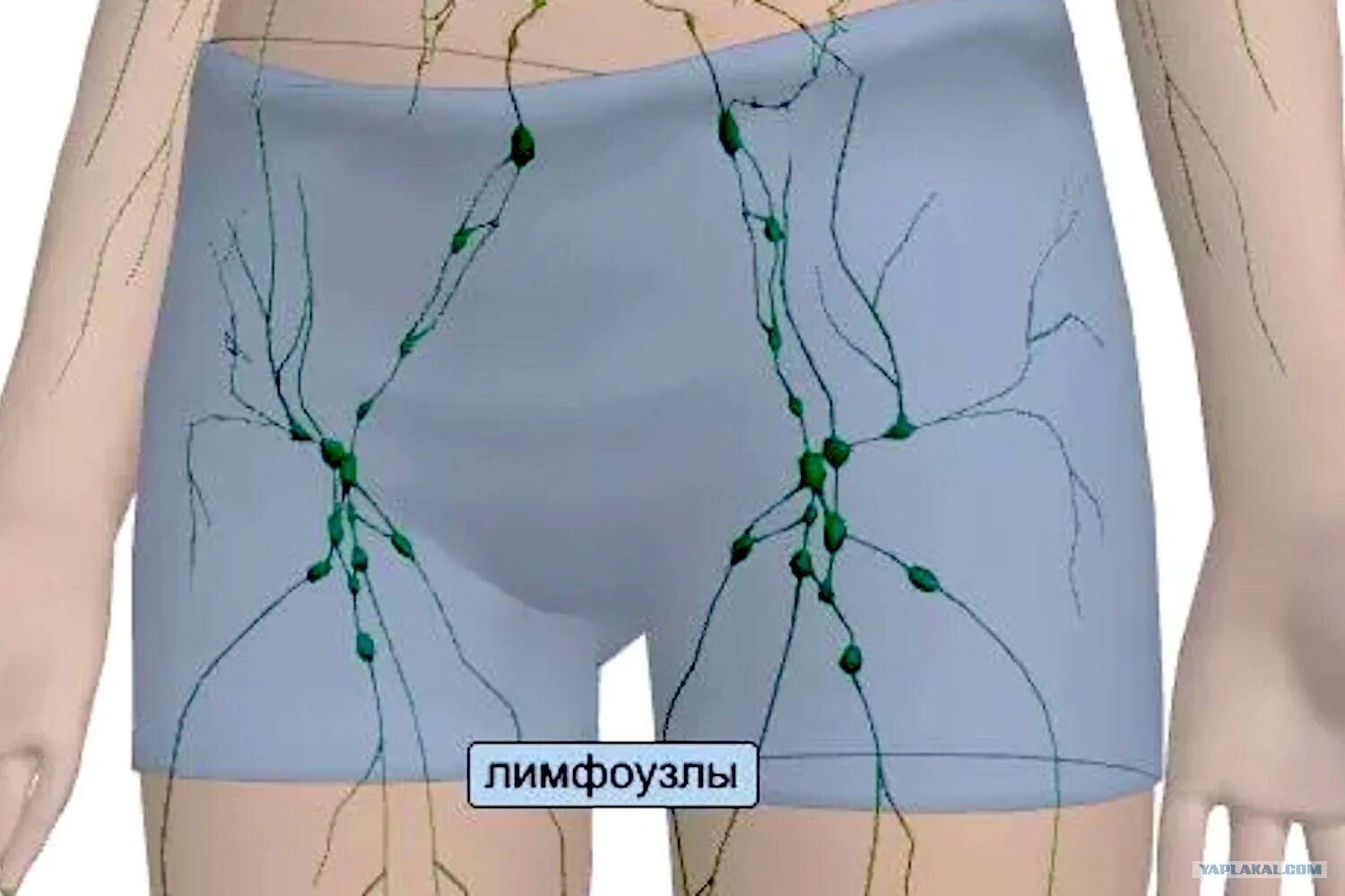 Расположение лимфоузлов в паху у женщин схема В паху находятся лимфоузлы: найдено 84 картинок