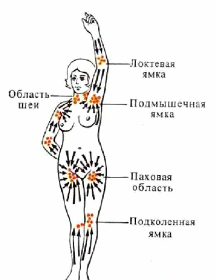 Расположение лимфоузлов в паху у женщин схема Где теле