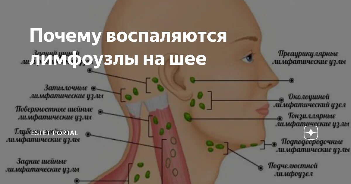 Расположение лимфоузлов возле уха фото Шейные лимфатические узлы у ребенка