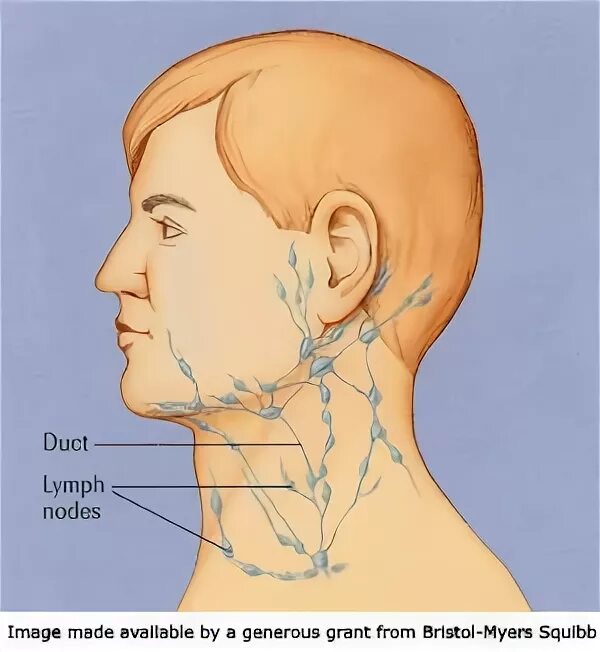 Расположение лимфоузлов возле уха фото Swollen lymph node on the neck for months, what could it be?