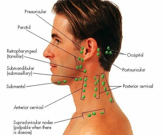 Расположение лимфоузлов возле уха фото Head Lymph Nodes Lymph nodes, Medical knowledge, Dental hygiene school