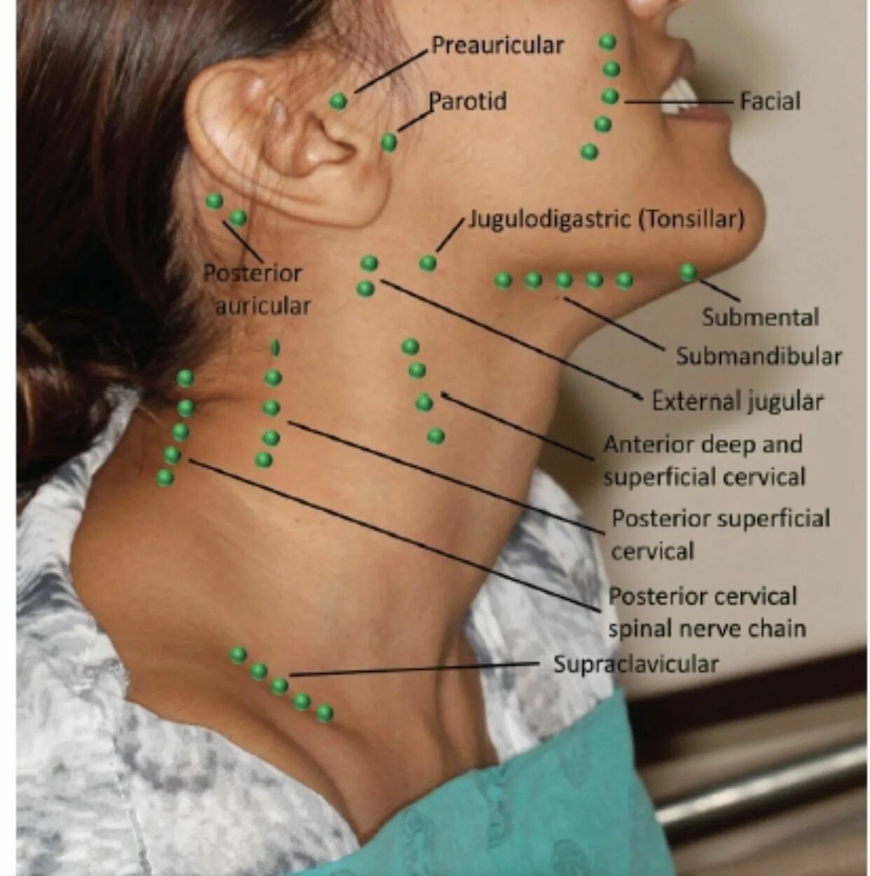 Расположение лимфоузлов возле уха фото Pin on Medical Medical anatomy, Dentistry, Dental hygiene school