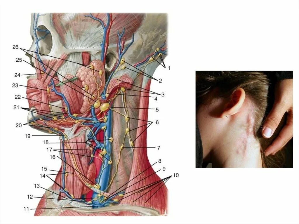 Расположение лимфоузлов возле уха фото Твердые лимфатические узлы