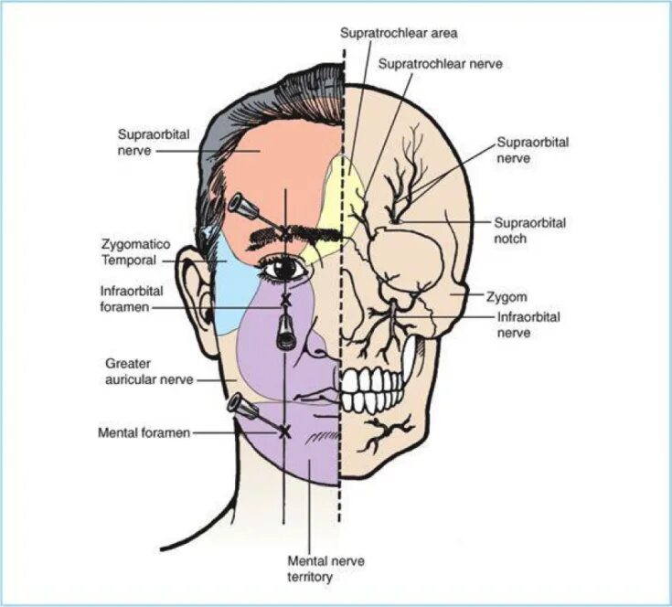 Расположение нервов на лице человека схема The main nerves of the face and the types of their damage during the introductio