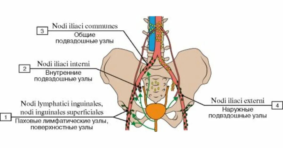 Расположение паховых лимфоузлов у женщин схема Лимфатические метастатические лимфатические узлы