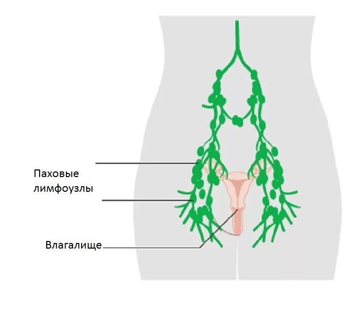 Расположение паховых лимфоузлов у женщин схема Лимфоузлы в паху у женщин: расположение, причины воспаления и особенности лечени