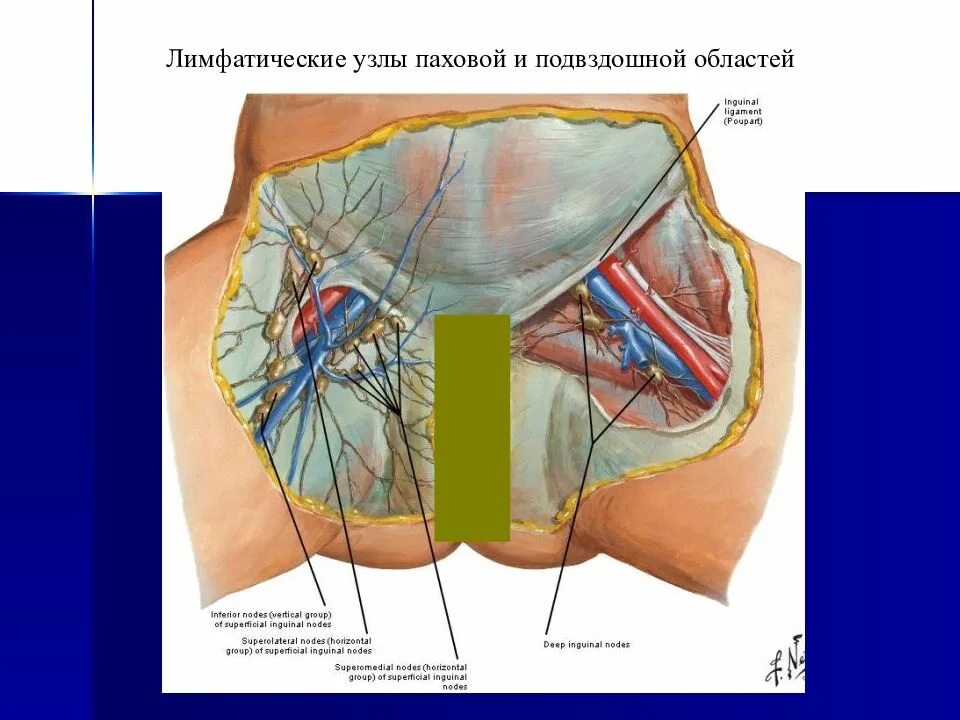 Расположение паховых лимфоузлов у женщин схема Картинки КАК НАЗЫВАЕТСЯ ПАХОВАЯ ОБЛАСТЬ