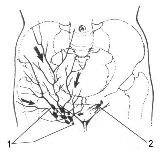 Расположение паховых лимфоузлов у женщин схема Глава 1. Анатомо-топографические особенности брюшной стенки и женских половых ор