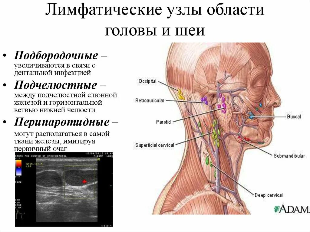 Расположение подчелюстных лимфоузлов у человека схема Картинки УВЕЛИЧЕНИЕ РАЗМЕРОВ ЛИМФАТИЧЕСКИХ УЗЛОВ