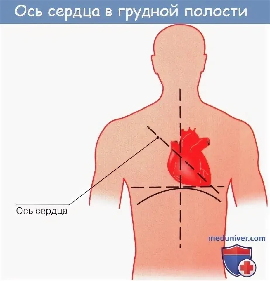 Расположение сердца у человека фото Анатомия: Топография сердца