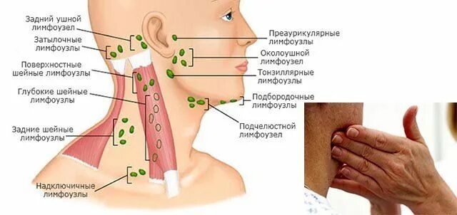 Расположение шейных лимфоузлов у человека схема https://www.liveinternet.ru/users/4651686/post468318688
