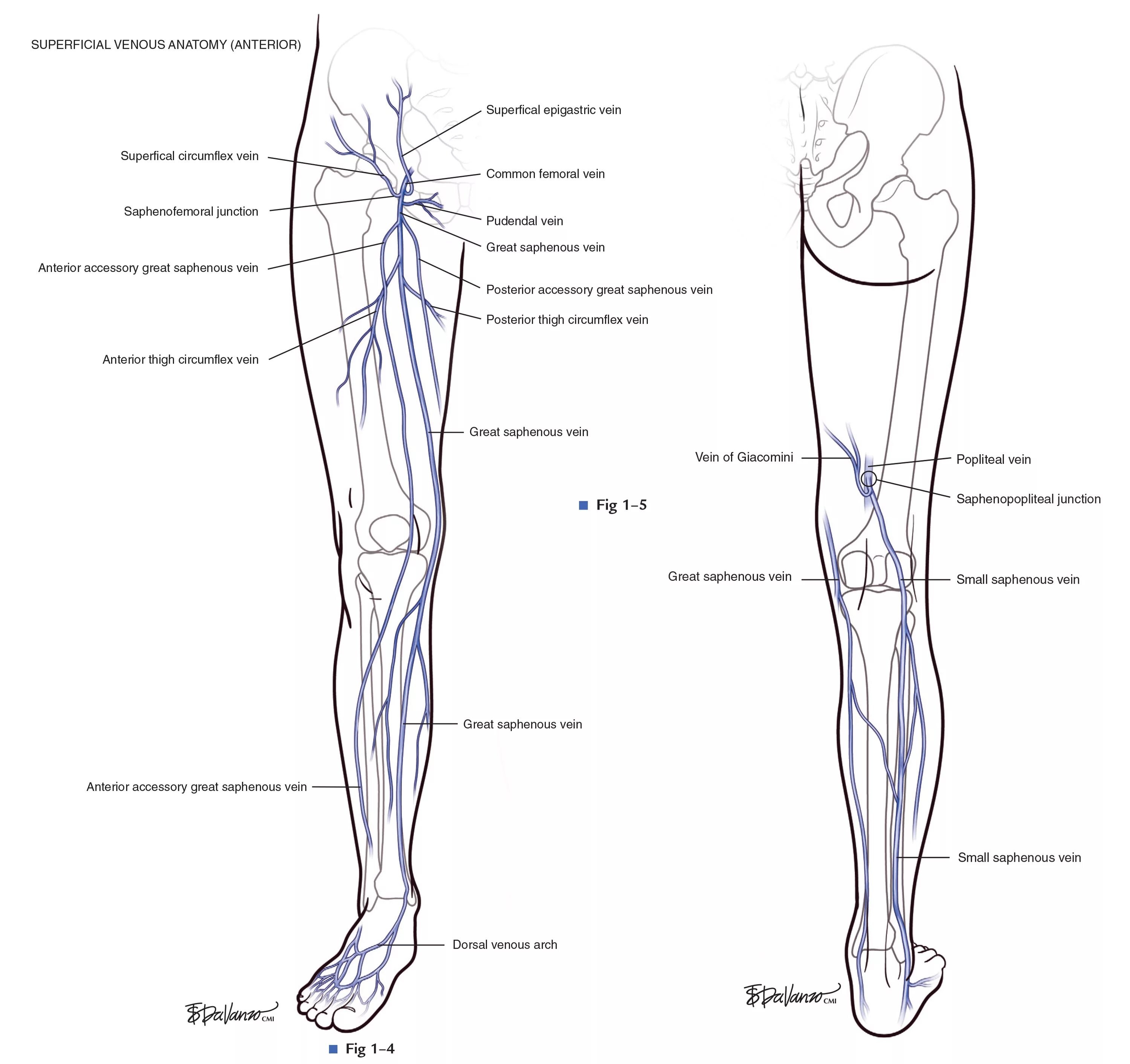 Расположение вен на ногах у женщин схема Greater Saphenous Vein Clot on Sale www.beztabaka.by