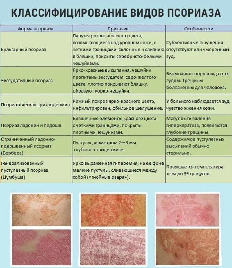 Распознать сыпь по фото онлайн Кожные заболевания и их признаки у взрослых