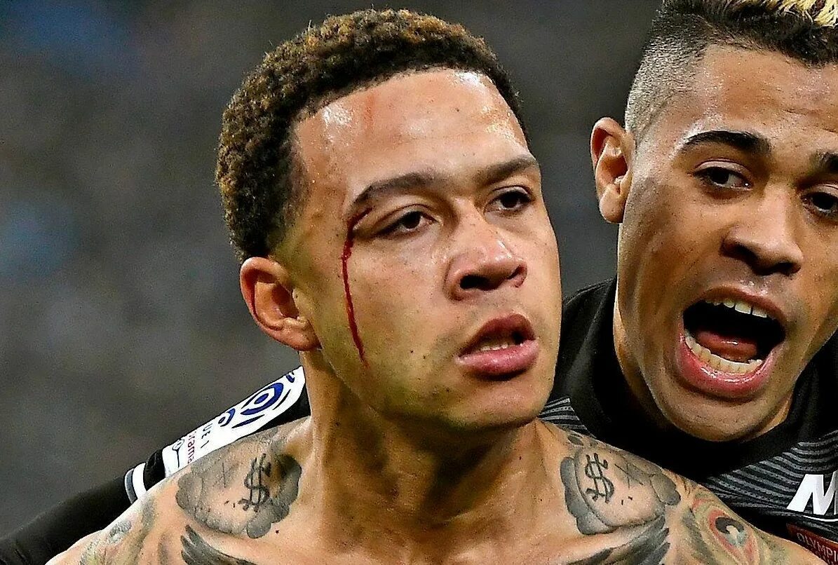 Рассечение брови фото Memphis Depay shows off gruesome eye gash being stitched after Lyon's win over M