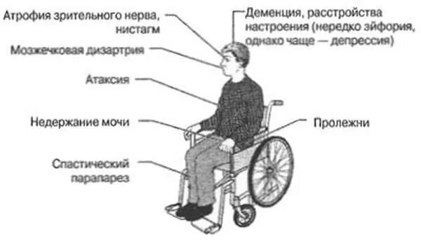 Рассеянный склероз симптомы фото Картинки КАК ЖИВЕТЕ С РАССЕЯННЫМ СКЛЕРОЗОМ ФОРУМ