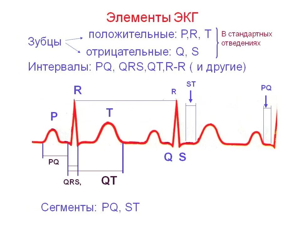 Расшифровать кардиограмму сердца онлайн по фото Расшифровка ЭКГ норма, таблица, параметры, элементы.