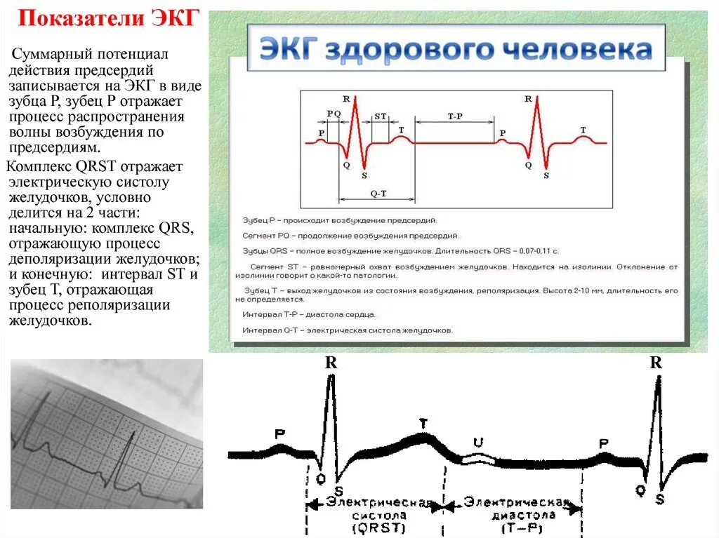 Расшифровать кардиограмму сердца онлайн по фото Расшифровка экг для чайников