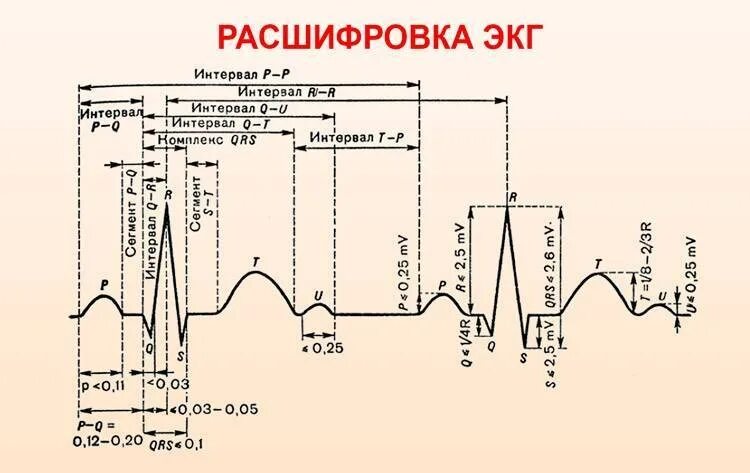 Расшифровать кардиограмму сердца онлайн по фото Как расшифровывают ЭКГ, какие показатели имеют значение