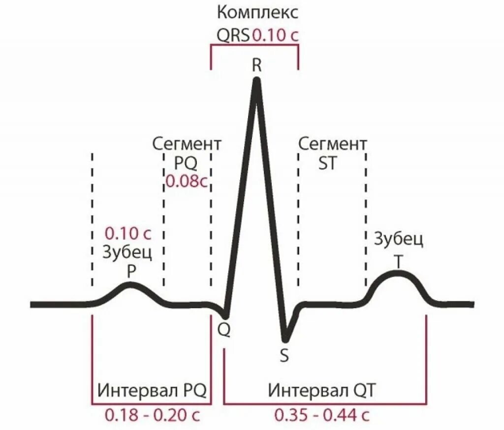 Расшифровать кардиограмму сердца онлайн по фото КАК ПРОЧИТАТЬ ЭКГ? Weird_Med_Student Дзен