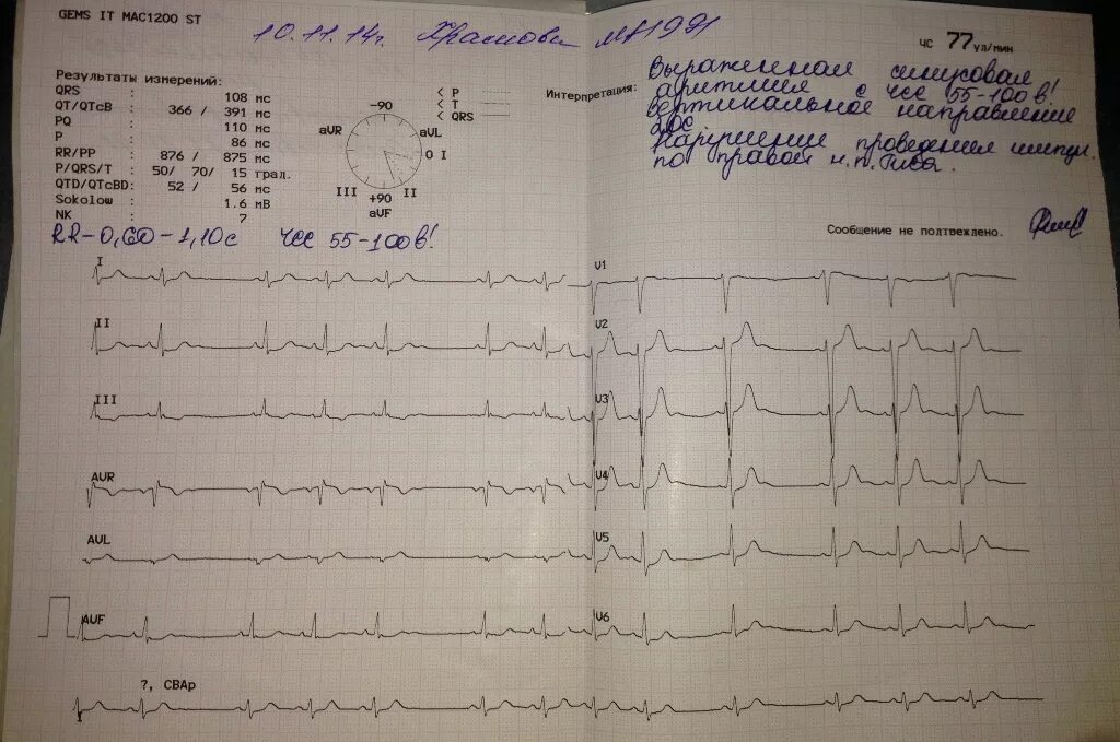 Расшифровать кардиограмму сердца онлайн по фото ЭКГ расшифровка - Вопрос кардиологу - 03 Онлайн
