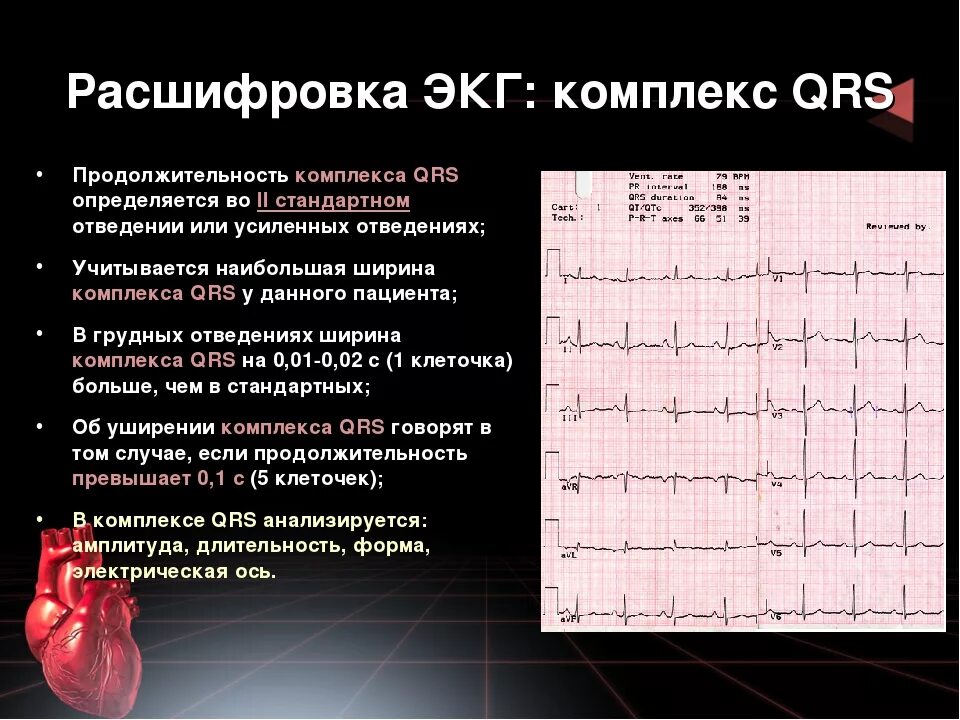 Расшифровка кардиограммы сердца онлайн по фото Экг сетка