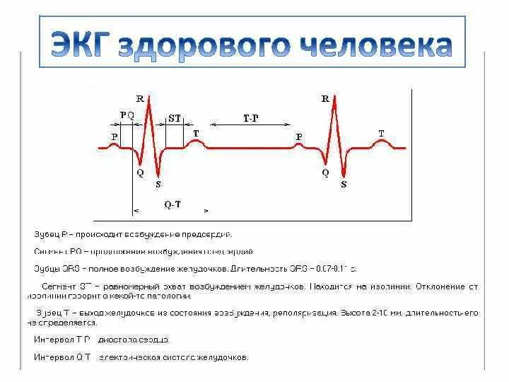 Расшифровка кардиограммы сердца онлайн по фото Сделал экг своего сердца не поверил но взглянул на диаграмму и нашел там твое им