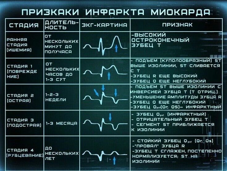 Расшифровка кардиограммы сердца онлайн по фото Пин от пользователя dead на доске Инста ❤ Медицина, Уроки биологии, Медицинский