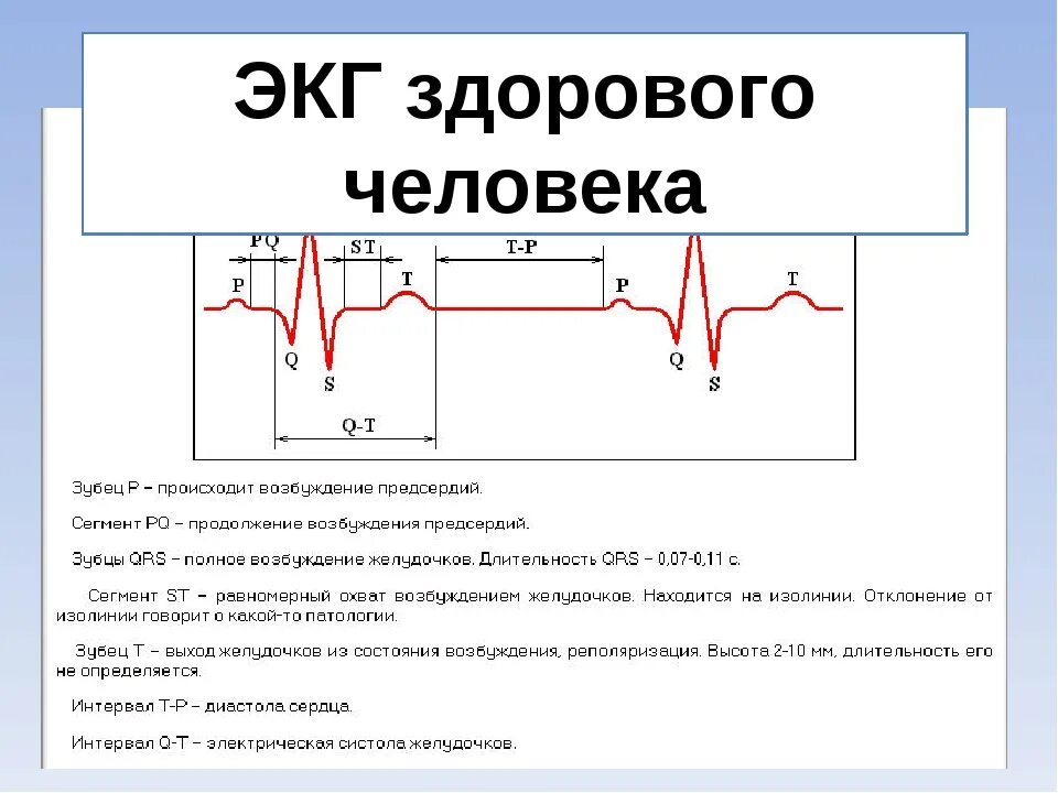 Расшифровка кардиограммы сердца онлайн по фото бесплатно Экг санкт петербург