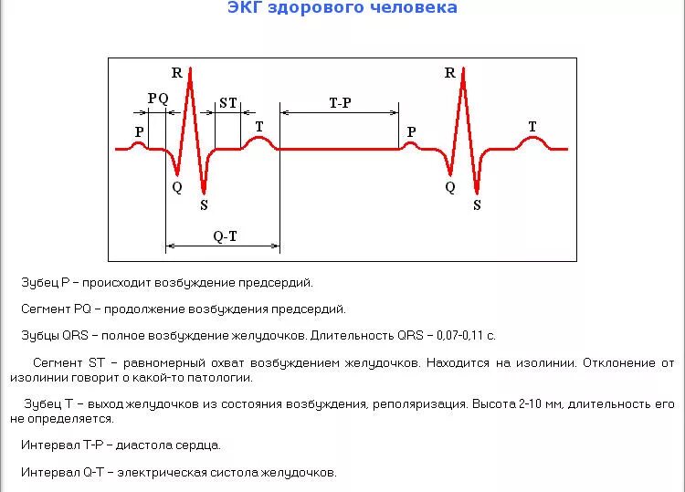 Расшифровка кардиограммы сердца онлайн по фото бесплатно Прочитать экг сердца