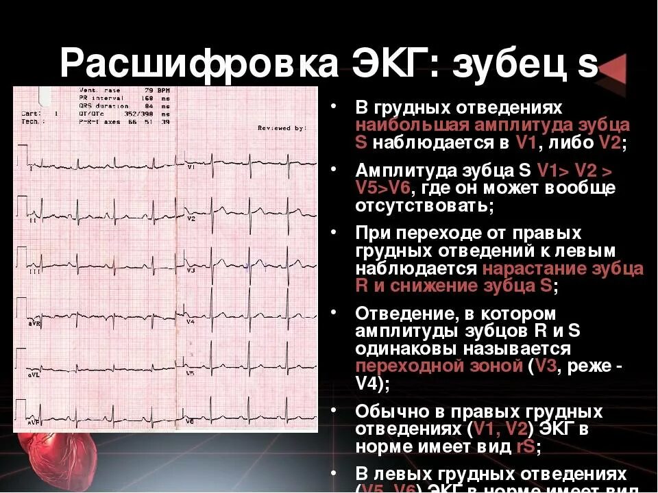 Расшифровка кардиограммы сердца у взрослых по фото Картинки КАК РАСШИФРОВАТЬ КАРДИОГРАММУ СЕРДЦА САМОСТОЯТЕЛЬНО У ВЗРОСЛОГО