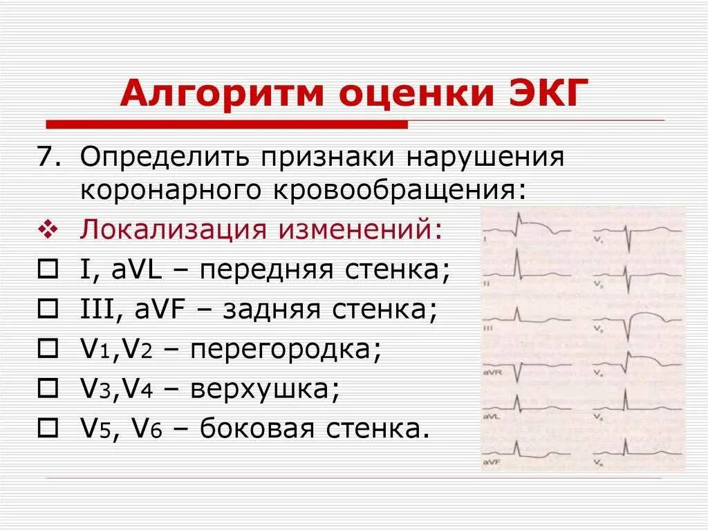 Расшифровка кардиограммы сердца у взрослых по фото Картинки РИТМЫ НА ЭКГ КАКИЕ