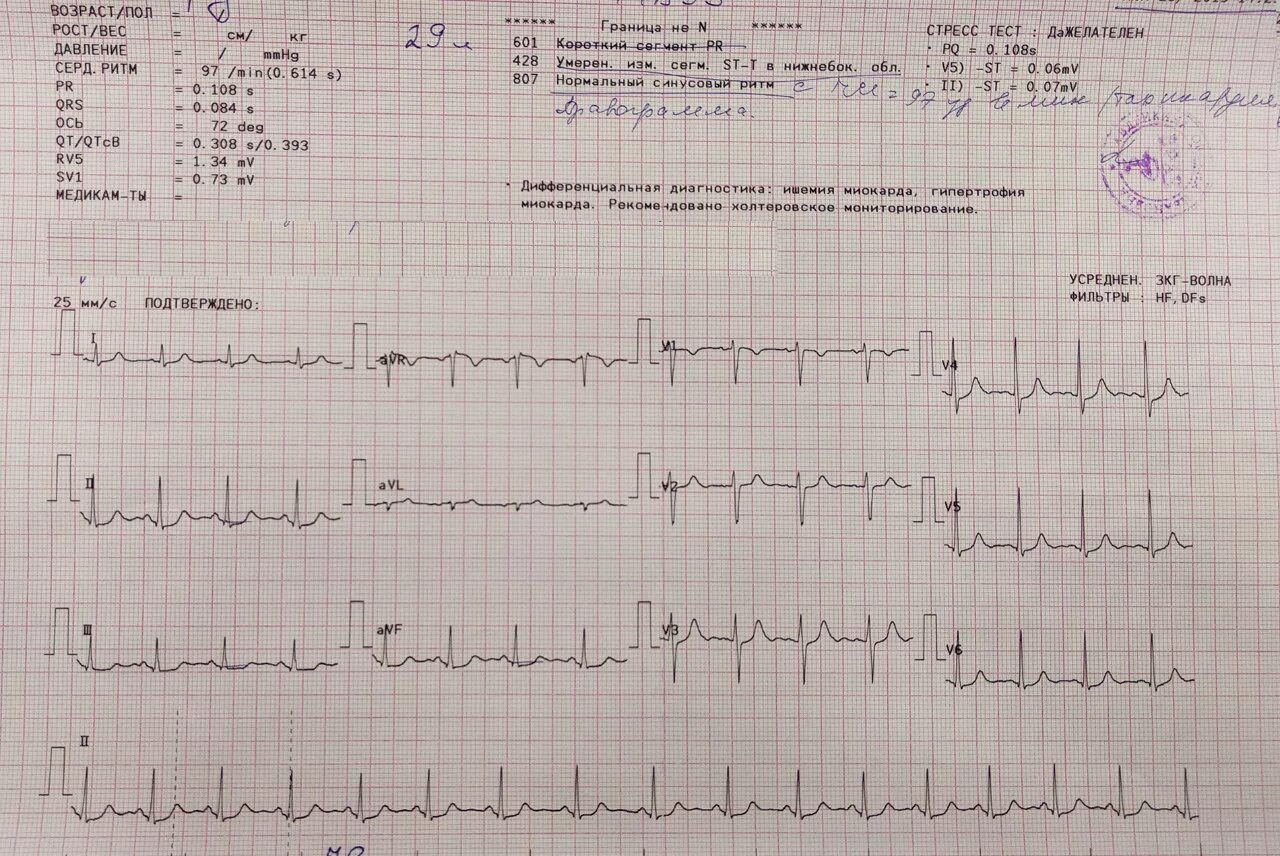 Расшифровка кардиограммы сердца у взрослых по фото Расшифровка результатов ЭКГ при беременности. Тахикардия - Вопрос кардиологу - 0