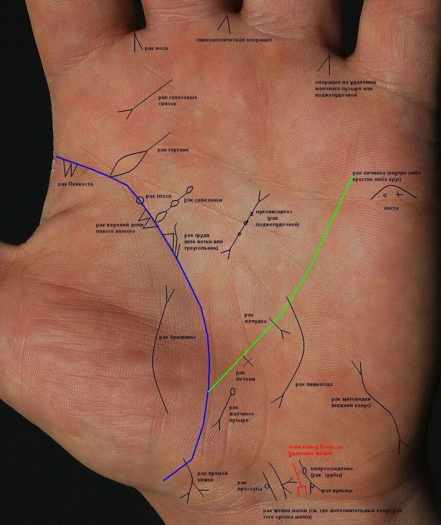Расшифровка жизни по фото руки ВОПРОСЫ о Знаках и Линиях на Ваших Руках (ПРОЧТИТЕ ПЕРВОЕ СООБЩЕНИЕ ТЕМЫ, несоот