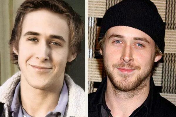 Райан гослинг фото до и после пластики ryan gosling plastic surgery Nose job, Plastic surgery, Celebrity plastic surger