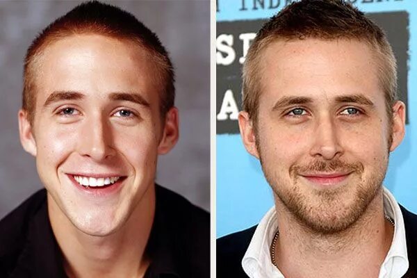 Райан гослинг фото до и после пластики Ryan Gosling - Ryan Gosling Nose Job Before and After Pics Nose job, Rhinoplasty