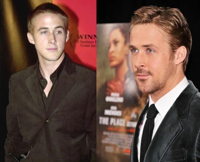 Райан гослинг фото до и после пластики Pin by Gail C. on For The Love of Ryan Plastic surgery, Ryan gosling, Surgery