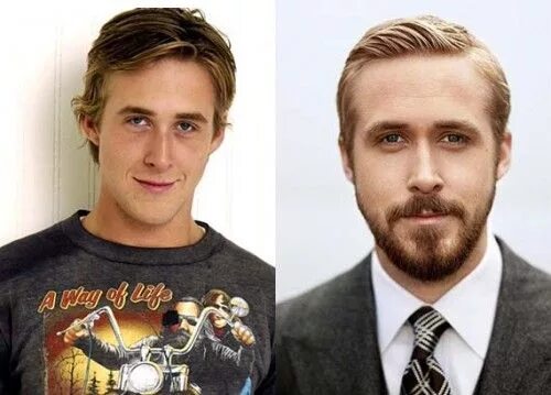 Райан гослинг фото до и после пластики Ryan Gosling Nose Job Before and After Photos - Celebrity Plastic Surgery Celebr