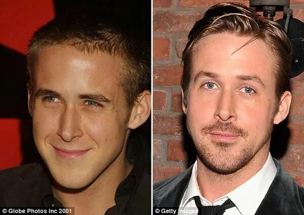 Райан гослинг фото до и после пластики Ryan Gosling Nose Job Before & After surgerybeforeafter.com