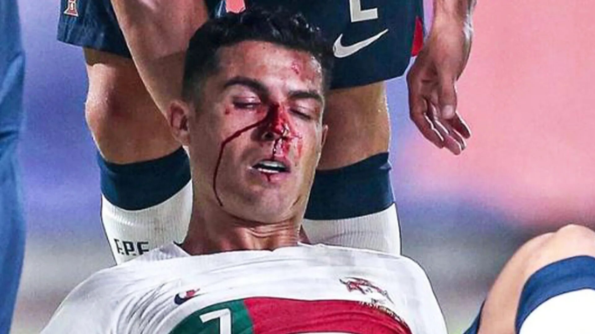 Разбили лицо фото Cristiano Ronaldo left covered in blood after being whacked in face by Czech kee