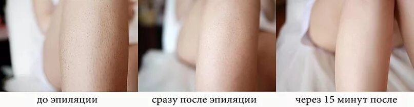 Раздражение на лице после бритья фото Раздражение после эпиляции: видео-инструкция как убрать своими руками, особеннос