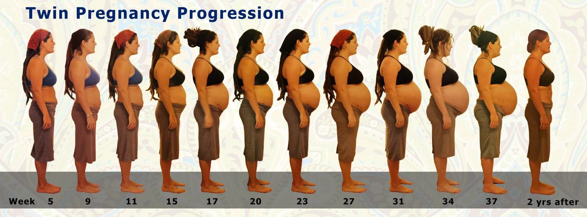 Размер живота по месяцам фото mental preparation Twin pregnancy, Twin pregnancy belly, Pregnancy timeline phot